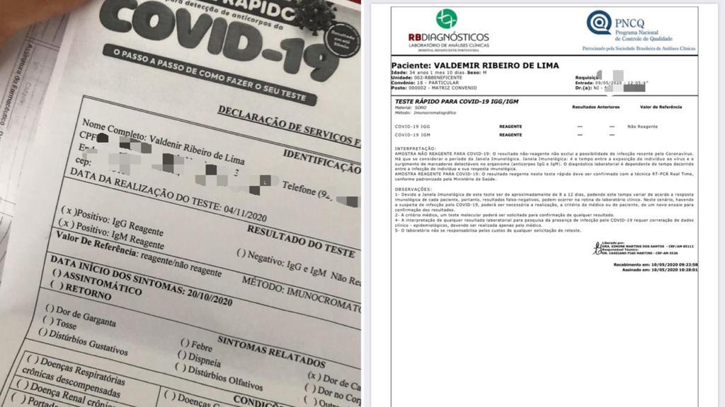 Em Manaus, administrador pega Covid duas vezes: “Reinfecção é real, totalmente!”