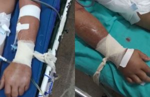 Polêmica: Jornal Nacional exibe pacientes com Covid amarrados a macas em ParintinsPandemia no interior