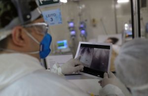 Amazonas confirma mais 7.467 novos casos de Covid e quatro mortes neste sábado