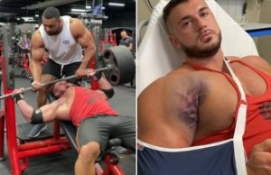 Fisiculturisra rasga músculo peitoral tentando levantar 220 quilos; veja vídeoAgonia