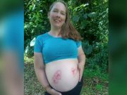 Mãe dá à luz a trigêmeos prematuros e vai direto para a UTI com Covid