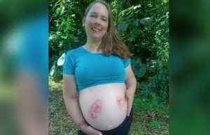 Mãe dá à luz a trigêmeos prematuros e vai direto para a UTI com CovidDrama