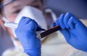 Acadêmicos da UEA criam site ‘COVID19MAP’ para mapear a pandemia no AmazonasNovidade