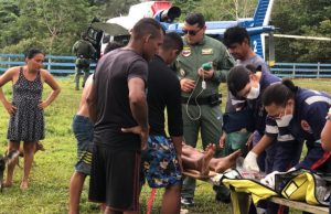 Vídeo mostra resgate dramático de homem picado por cobra em ManausQue agonia