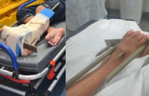 Adolescente tenta pular grade de igreja e fica com a lança atravessada no pé em ManausHorror
