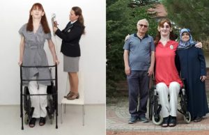 Mulher de 2,15 metros se torna a mais alta do mundo, aos 24 anos