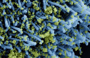 Alerta: descoberta nova variante do coronavírus com grande número de mutaçõesVariante foi encontrada pela primeira vez em Botsuana