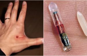 Empresa lança chip na pele para guardar dados de vacina; internautas falam em “Marca da Besta”