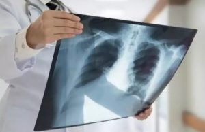 Tragédia em família: idoso morre engasgado durante ceia de Natal em ManausAcidente doméstico