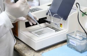 URGENTE: Amazonas registra 1.219 novos casos de Covid-19, diz FVS