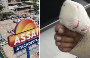 Mulher tem o dedão do pé decepado por empilhadeira do Assaí AtacadistaPerigo no supermercado