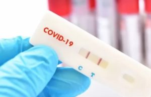 Anvisa recebe primeiro pedido de registro para autoteste de covid-19