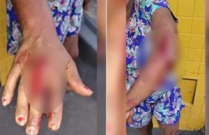 Mulheres bêbadas brigam por chinelo e uma acaba esfaqueadaQue situação!