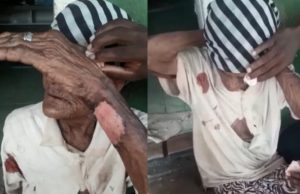 Perversidade: idosa de 103 anos é brutalmente espancada durante assalto
