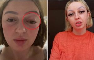 IMPRESSIONANTE – Mulher faz tanta força durante parto que olho ‘pula para fora’