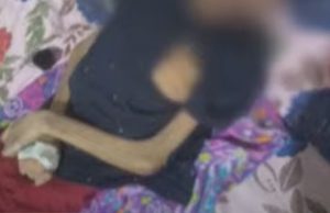 MAUS-TRATOS: adolescente deficiente resgatado em Manaus está na UTI