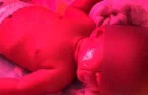 JUDIAÇÃO! Mãe cola fita adesiva para tapar boca da filha de 6 meses: ‘momento de bobeira’