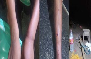 Adolescente ‘nasce de novo’ após ser salvo da morte por policiais em BorbaA vítima foi sequestrada por dois homens e encontrada horas depois com as mãos e pés amarrados, bastante machucada