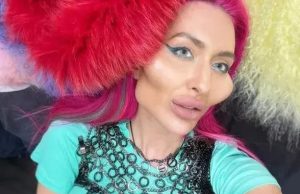 Modelo com as maiores bochechas do mundo exibe novo implante