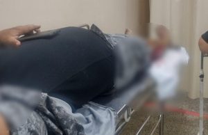 Durante ação em Manaus, subtenente da Rocam atira acidentalmente na própria perna