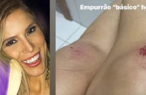 Agredida na festa do Caprichoso, ex-BBB Milena Fagundes desabafa: ‘gente sem educação’Violência