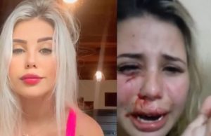 “Me ajuda, por favor!”: influencer é espancada pelo namorado e pede socorro em vídeo