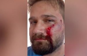 Médico é agredido por pai de paciente após negar atestado de 3 dias