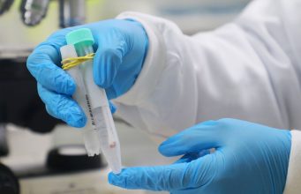 Amazonas tem 74 novos casos de Covid-19 em 24 horas