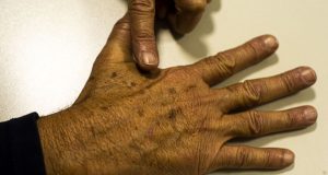 Brasil terá 704 mil novos casos de câncer por ano até 2025, diz IncaMama e próstata são as doenças de maior incidência