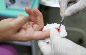 Dezembro Vermelho: SPA e Policlínica José Lins intensifica ações de testagem para HIV/AIDSA unidade destaca que o Centro de Testagem e Aconselhamento realizou mais de 2.500 testes rápidos para IST, em 2022