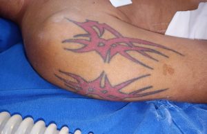 HPS João Lúcio procura familiares de paciente sem identificação internado na unidadePaciente está sob os cuidados da equipe de intensivistas da unidade