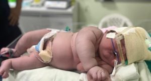 Bebê GIGANTE com 7 kg nasce em Parintins e deixa médicos surpresos