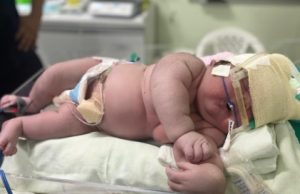 Bebê GIGANTE com 7 kg nasce em Parintins e deixa médicos surpresos