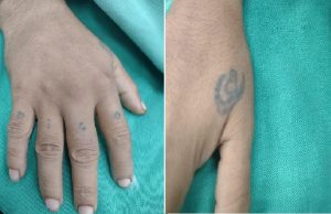 HPS João Lúcio pede ajuda para localizar familiares de paciente internado na unidadePaciente deu entrada no hospital sem documentos de identificação