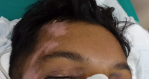 HPS João Lúcio procura familiares de paciente que está internado na unidadeO paciente foi vítima de agressão física e tem identidade desconhecida. HPS João Lúcio procura familiares de paciente que está internado na unidade