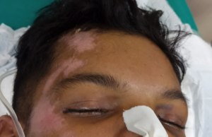 HPS João Lúcio procura familiares de paciente que está internado na unidadeO paciente foi vítima de agressão física e tem identidade desconhecida. HPS João Lúcio procura familiares de paciente que está internado na unidade