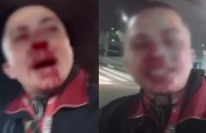 Vídeo: Em São Paulo, entregadores fazem protesto após um colega denunciar agressãoO protesto de entregadores em São Paulo, após um colega denunciar agressão, é um exemplo da crescente insatisfação da categoria com a violência e a falta de respeito que eles enfrentam no dia a dia. Vídeo: Em São Paulo, entregadores fazem protesto após um colega denunciar agressão