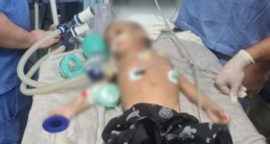 Criança de dois anos é espancada e internada em estado grave em Manaus Criança de dois anos é espancada e internada em estado grave em Manaus