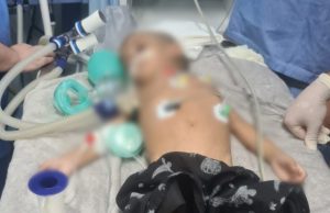 Criança de dois anos é espancada e internada em estado grave em Manaus Criança de dois anos é espancada e internada em estado grave em Manaus