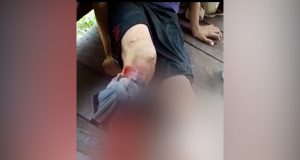 Homem é atacado por jacaré e tem perna ferida no interior do AMUm vídeo compartilhado nas redes sociais mostra a vítima no chão e sangrando bastante. Homem é atacado por jacaré e tem perna ferida no interior do AM