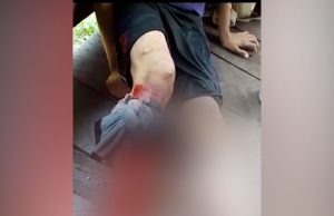 Homem é atacado por jacaré e tem perna ferida no interior do AMUm vídeo compartilhado nas redes sociais mostra a vítima no chão e sangrando bastante. Homem é atacado por jacaré e tem perna ferida no interior do AM