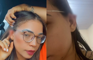 Vendedora de semijoias tem orelha arrancada após cobrar dívida de cliente Vendedora de semijoias tem orelha arrancada após cobrar dívida de cliente