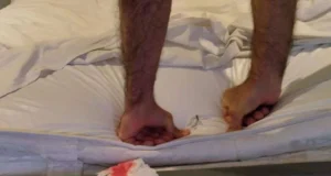Motel é condenado a indenizar cliente por prego na cama Motel é condenado a indenizar cliente por prego na cama