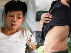 A venda de um rim: uma história de arrependimento e reflexão A venda de um rim: uma história de arrependimento e reflexão