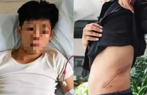 A venda de um rim: uma história de arrependimento e reflexão A venda de um rim: uma história de arrependimento e reflexão