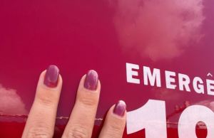 Em Manaus, mais de 400 pessoas são socorridas, por ano, com anéis presos aos dedosO CBMAM utiliza ferramentas de corte específicas para retirar o material em segurança. Em Manaus, mais de 400 pessoas são socorridas, por ano, com anéis presos aos dedos