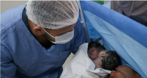 Parto raro de gêmeas siamesas é realizado com sucesso na rede pública de saúde do AmazonasBebês nasceram bem e devem passar por avaliação cirúrgica para procedimento de separação. Parto raro de gêmeas siamesas é realizado com sucesso na rede pública de saúde do Amazonas