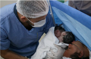 Parto raro de gêmeas siamesas é realizado com sucesso na rede pública de saúde do AmazonasBebês nasceram bem e devem passar por avaliação cirúrgica para procedimento de separação. Parto raro de gêmeas siamesas é realizado com sucesso na rede pública de saúde do Amazonas